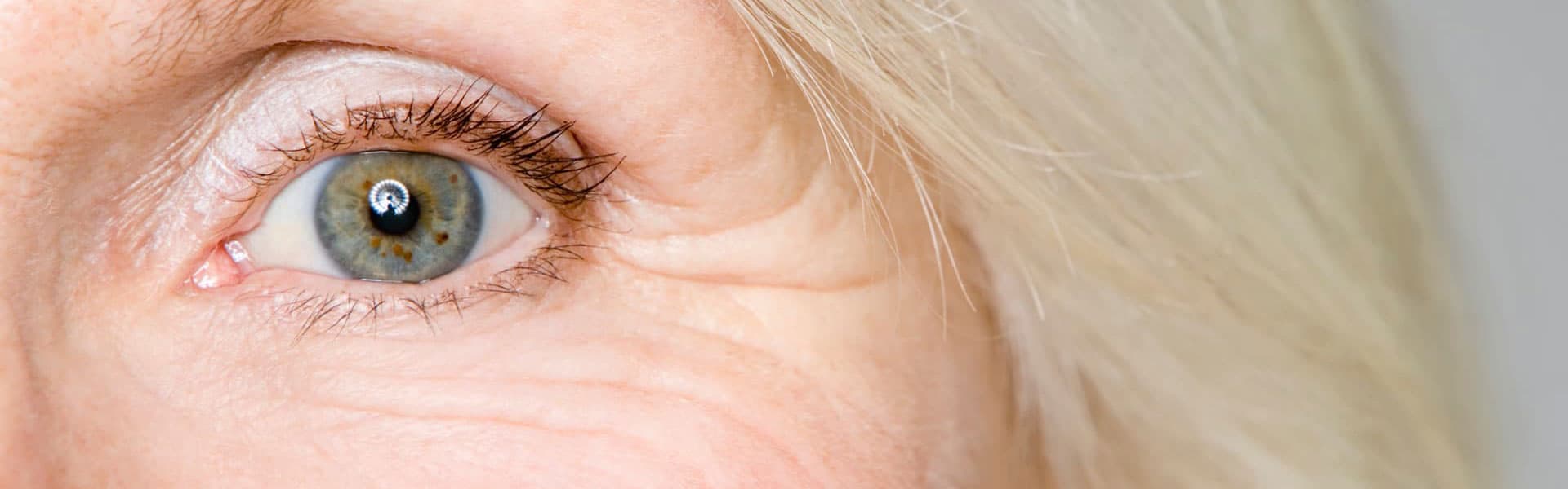 Close-up of wrinkles around the eyes, highlighting a common sign of aging.