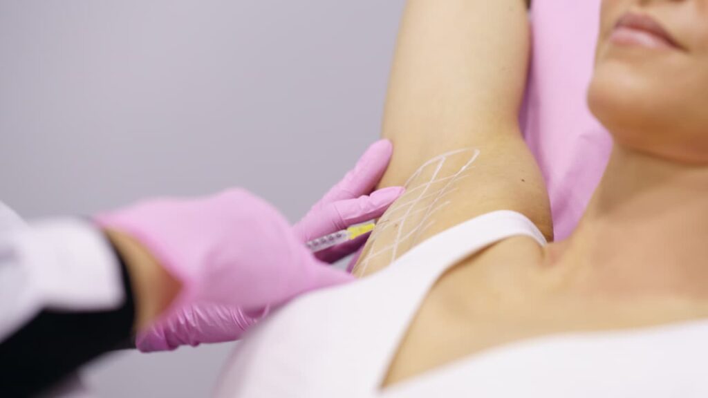 Female client at Evolve Med Spa receiving underarm botox treatment to reduce excessive sweating