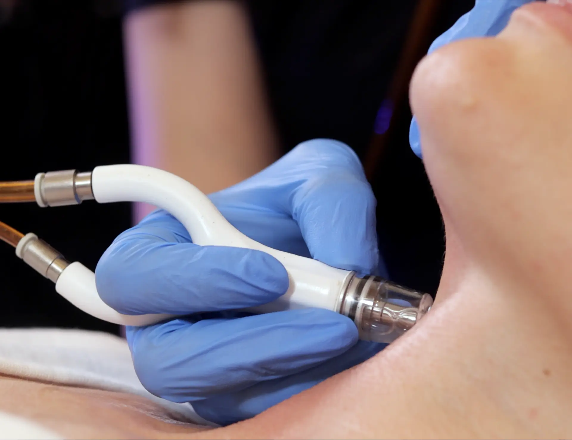 A close-up of a professional performing a DiamondGlow facial treatment. Gloved hands hold a specialized device applying gentle suction and exfoliation on a client’s neck, demonstrating a precise skincare procedure.