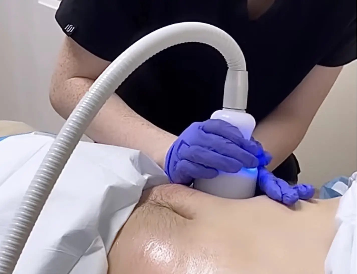 Specialist performing a Neveskin treatment using advanced equipment, focusing on body contouring and care.