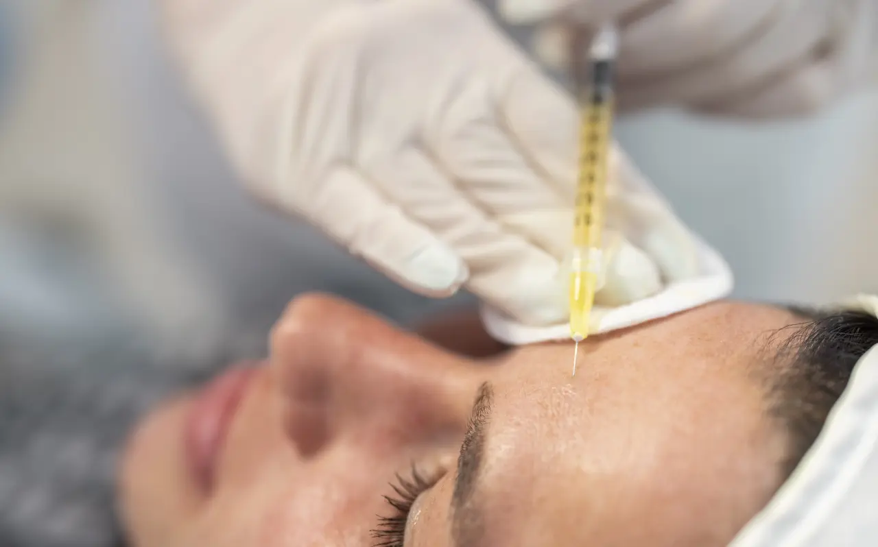 Close-up of a PRP (Platelet-Rich Plasma) skin rejuvenation treatment, with a gloved professional injecting PRP into the forehead of a patient lying down, enhancing skin healing and rejuvenation.