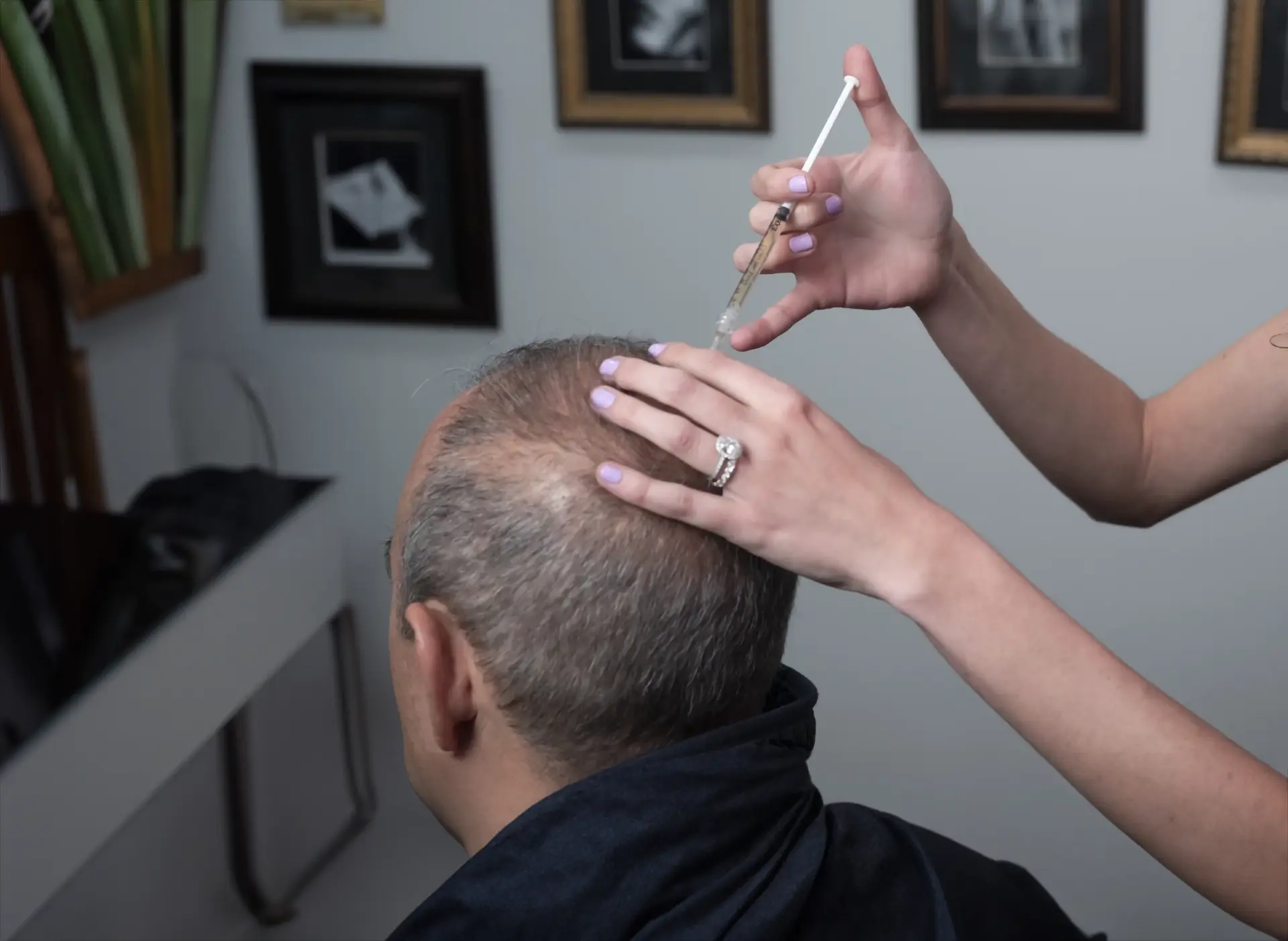 Patient receiving hair treatment