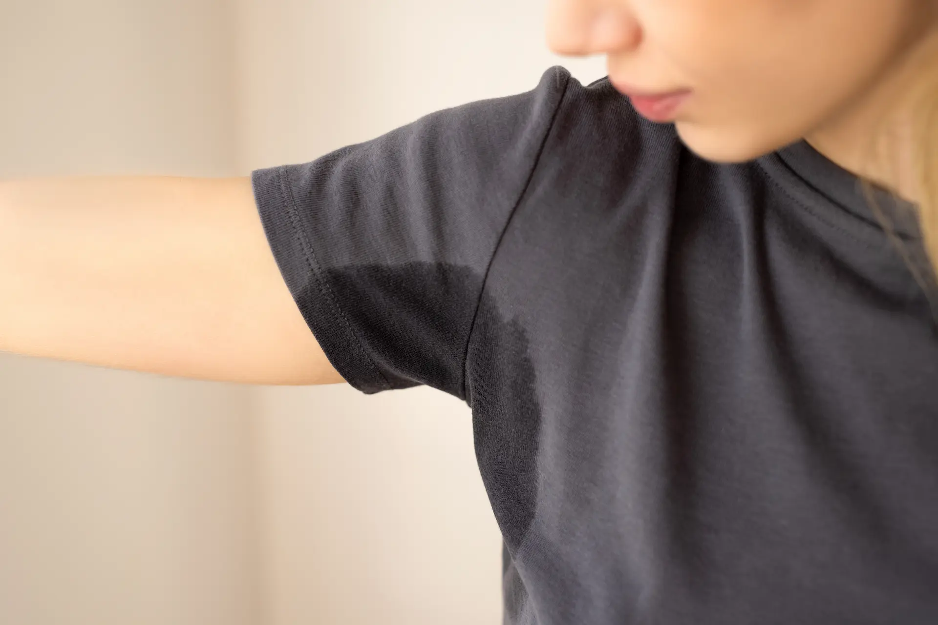 Excessive Sweating (Hyperhidrosis): Causes and Treatment Options