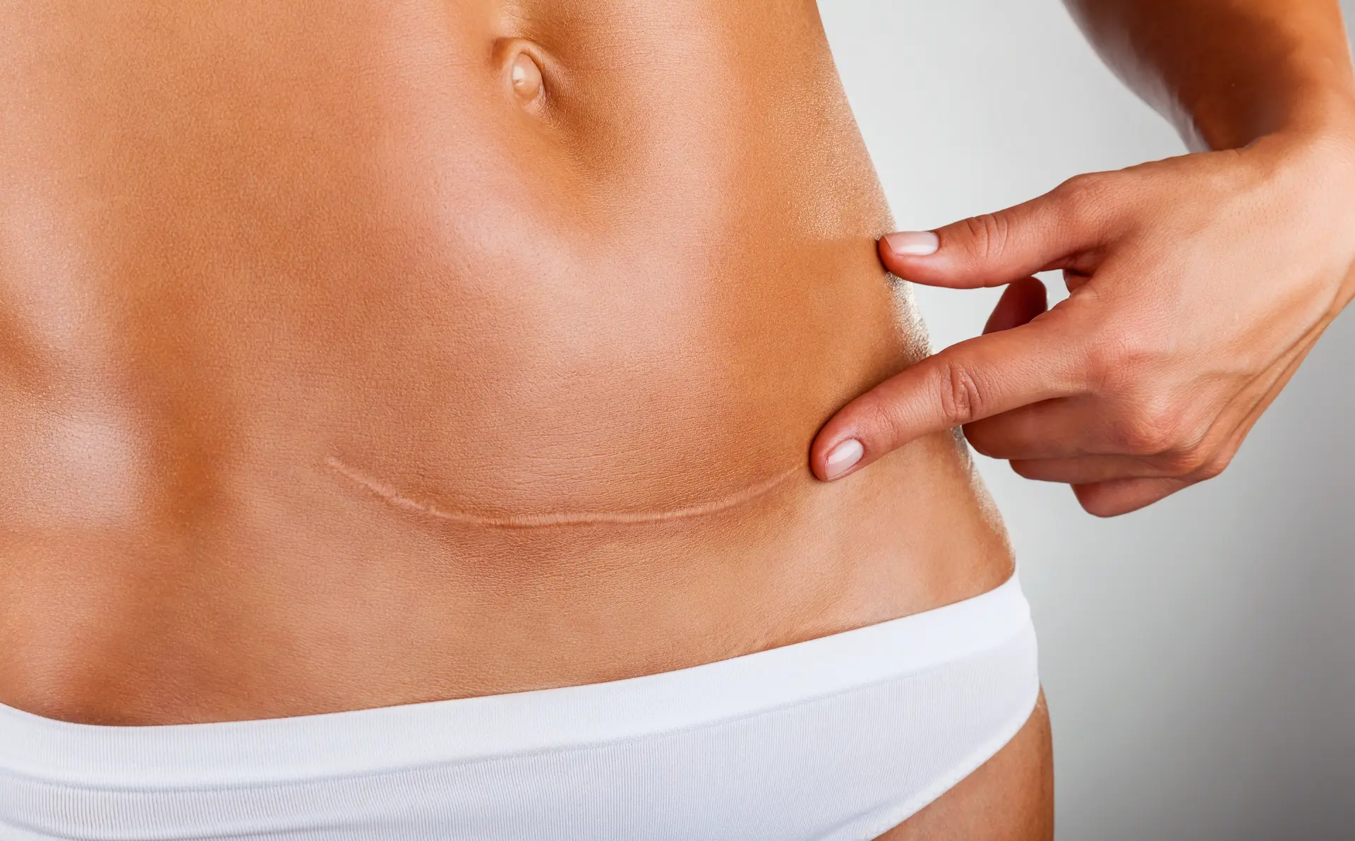 Surgical Scar Removal: Effective Treatments for Smoother Skin