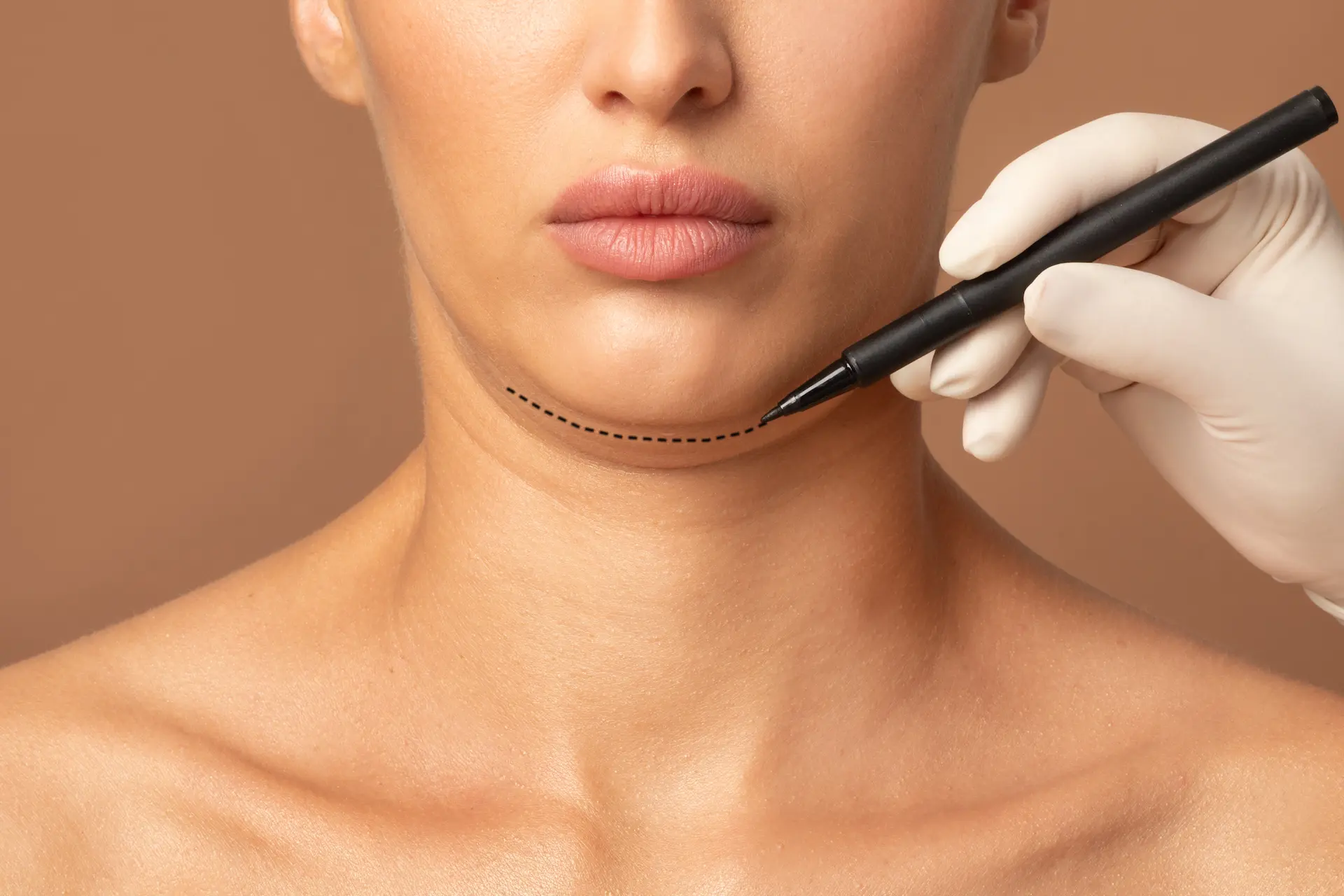 Double Chin: Causes and Treatment Options for a More Defined Jawline 